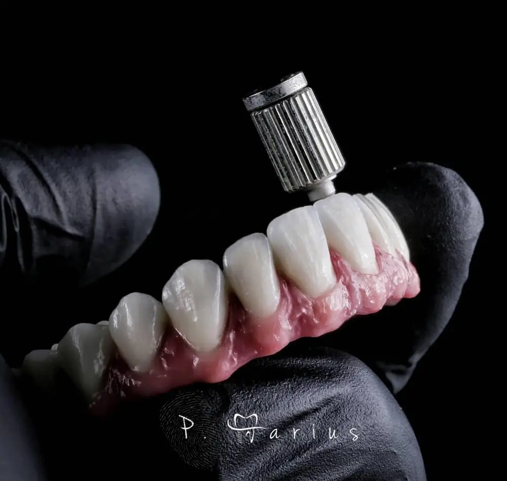 Lucrare dentară frezată CAD/CAM în laboratorul Art Dent