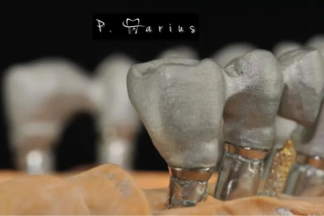 Structuri metalice pe modelul de lucru