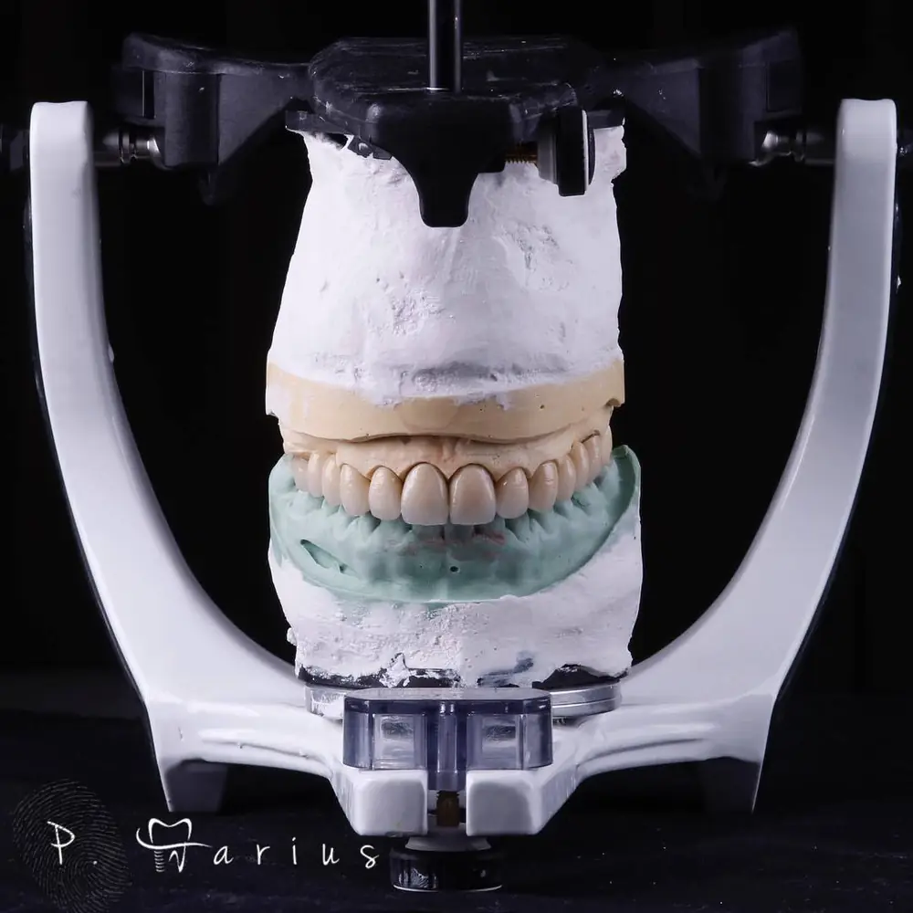 Modele dentare montate în articulator